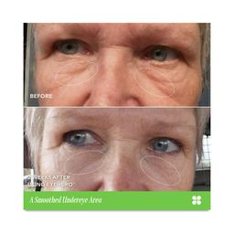 EyeHero, Bio-Retinol + Honey Locust Smoothing Eye Cream