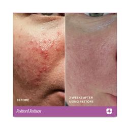 Restore, Ceramides + Gotu Kola Barrier Repair Cream