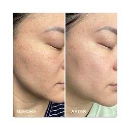 Jelly Drops, Kakadu Plum + Mushroom Hyaluronic Acid Serum