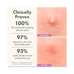 Miracle Patch Overnight Spot Cover