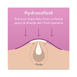 Miracle Patch Overnight Spot Cover