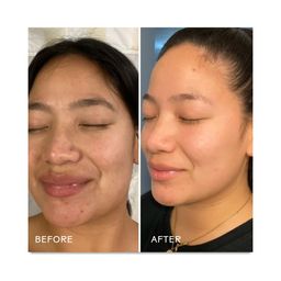 Dream, Bio-Retinol + Shorea Butter Rejuvenating Cream