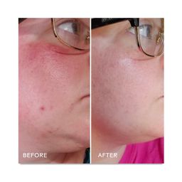 Radiance, Grape Stem Cell + Squalane Ultra-Hydrating Cream