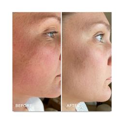 Skin Hero, Calendula + 2% Bakuchiol Bio-Retinol Serum